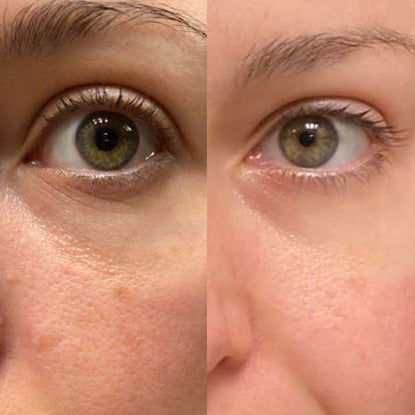 Anti-Aging Sea Moss Face Mask